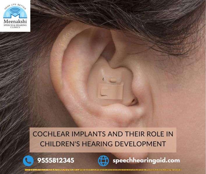 Cochlear Implants and Their Role in Children’s Hearing Development