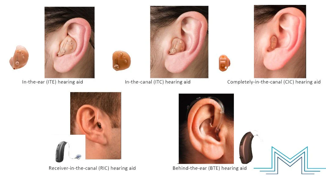 Hearing Aids for Different Levels of Hearing Loss featured image